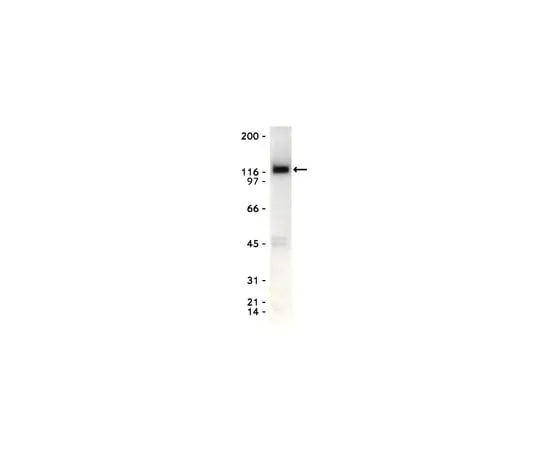 62-8371-31　抗Eck/EphA2,克隆D7;200μg　05-480