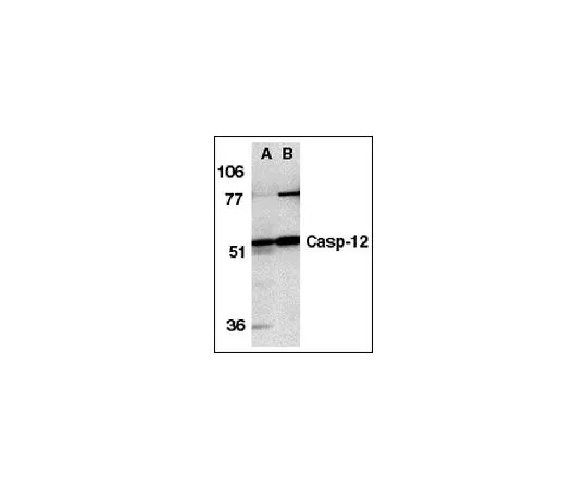 62-8448-28　抗caspase 12, N末端;100μg　AB3613