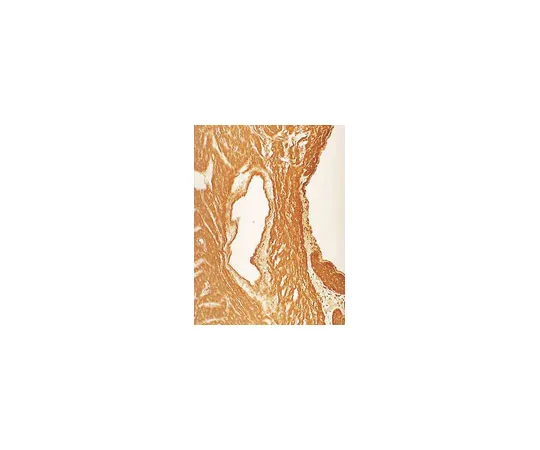 62-8370-65　抗硝基酪氨酸，克隆1A6;100μg　05-233