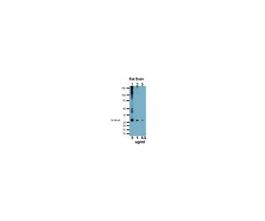 62-8446-43　抗水通道蛋白4;100μg　AB2218