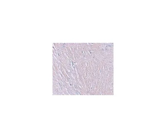 62-8467-49　反SYNPO　ABN481
