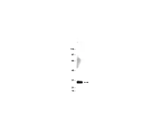 62-8371-35　反FDD,克隆1F7;100μg　05-486