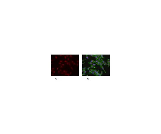 62-8461-63　抗TIF1α　ABE434