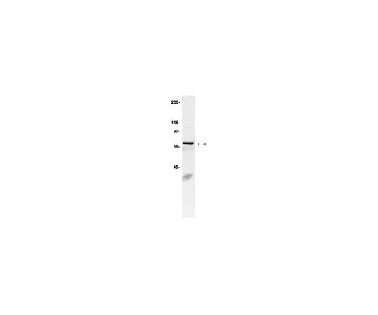 62-8383-53　抗gp91-phoos;200μg　07-024