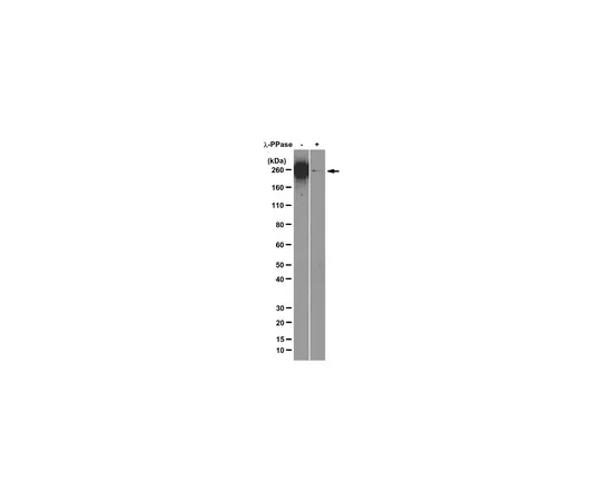 62-8369-48　抗RNA聚合酶II亚基B1 (磷酸化CTDSer-2) ，克隆3E10;100μg　04-1571