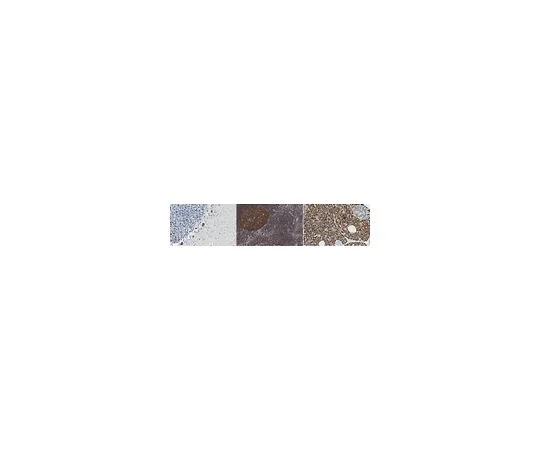 62-8463-83　抗La相关蛋白1　ABE1800