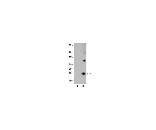 62-8396-18　抗硝基-α/β-突触核蛋白，克隆nSyn12;200μL　36-011