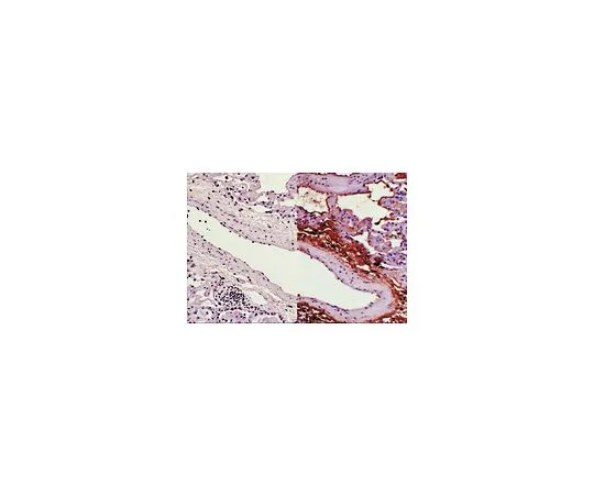 62-8381-26　抗硝基酪氨酸;100μg　06-284
