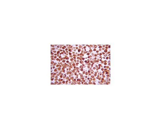 62-8387-79　抗IKKβ;100μg　07-1479