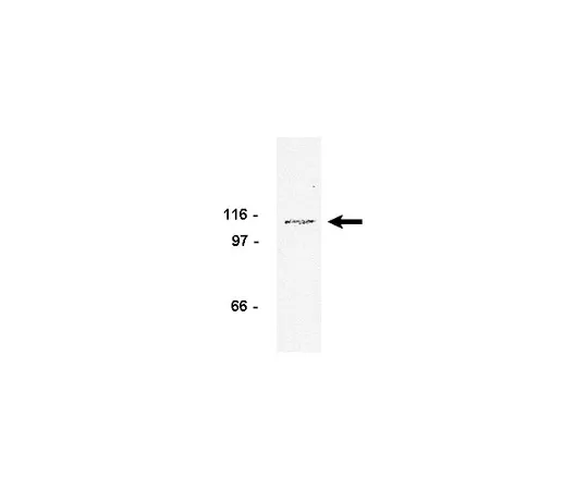 62-8370-43　抗FGFR1,克隆19B2;250μg　05-149