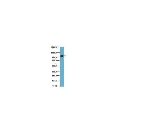 62-8386-07　反Sp1;100μg　07-645