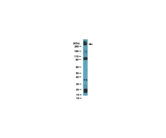 62-8369-44　抗NSD1,克隆1NW-1A10;100μL　04-1565