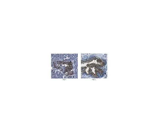 62-8458-10　抗ATP柠檬酸盐合酶/ACLY　ABC426