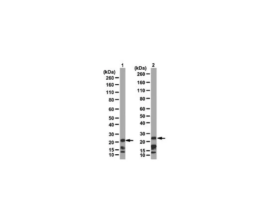 62-8387-08　抗Chromobox蛋白同源物7 (Cbx7);100μg　07-981