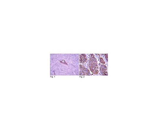 62-8381-69　反TrkA;200μg　06-574