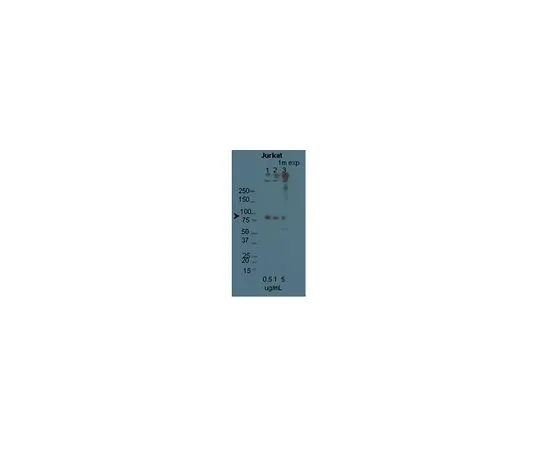 62-8453-80　抗STIM1;100μg　AB9870