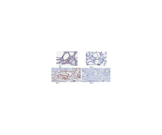 62-8375-43　抗FOXO3a/FKHRL1,克隆15F7.2;100μg　05-1587