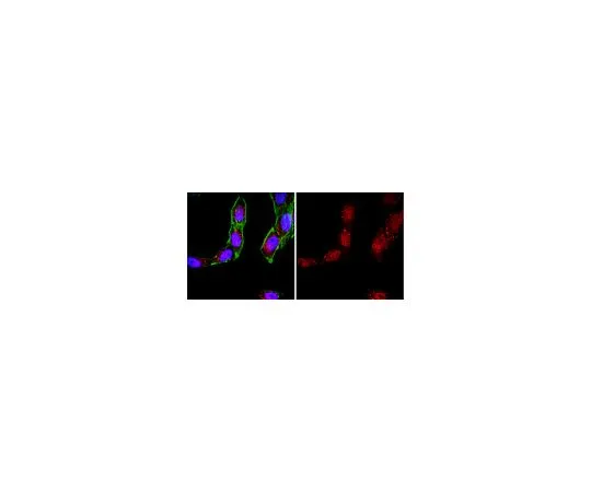 62-8456-32　Anti-Bak (N末端);100μg　ABC12