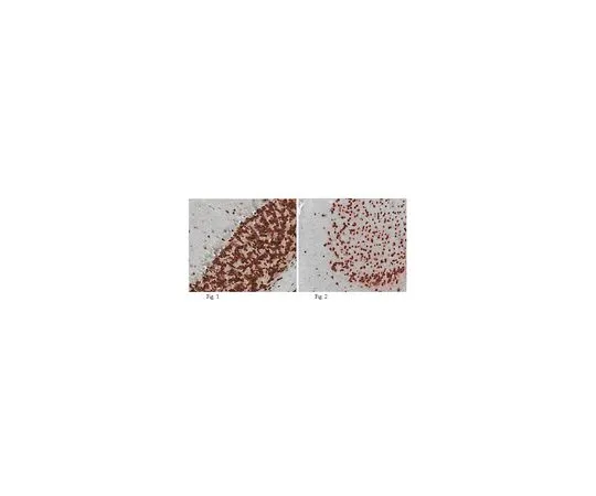 62-8465-68　反神经网络;100μL　ABN90