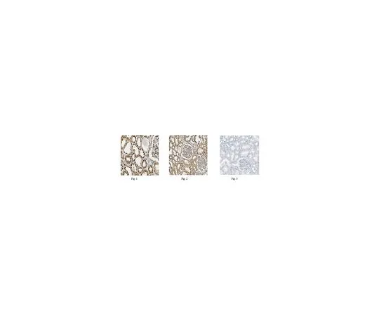 62-8462-12　反PRDM16　ABE543