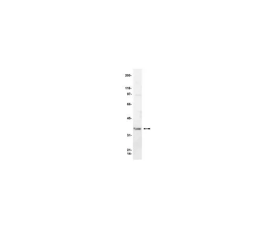 62-8381-21 抗G-βββββββββββββββββββββββββββββββββββββββββββββββββββββββββββββββββββββββββββββββββββββββββββββββββββββββββββββββββββββββββββββββββββββββββββββββββββββββββββββββββββββββββββββββββββββββββββββββββββββββββββββββββββββββββββββββββββββββββββββββββββββββ;50μL 06-238