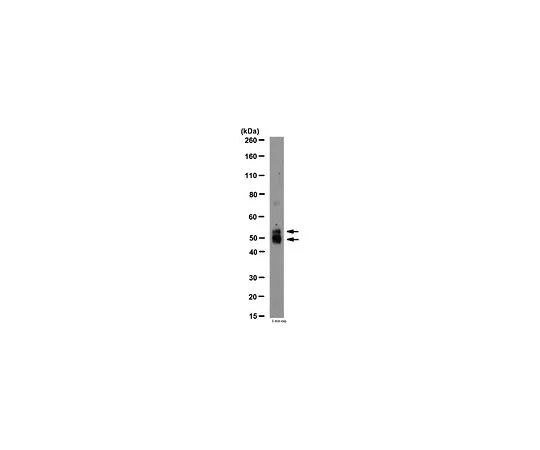 62-8452-27　抗MMP-12, N项 (活性);100μg　AB6010