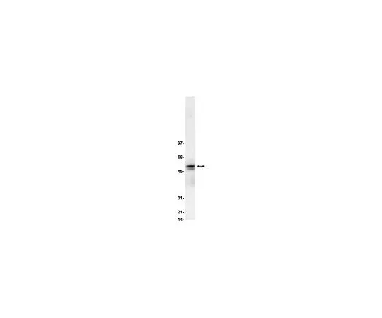 62-8381-14　反Lyn;250μL　06-207