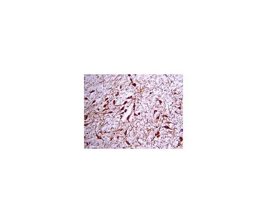62-8444-33　抗酪氨酸羟化酶;100μL　AB152
