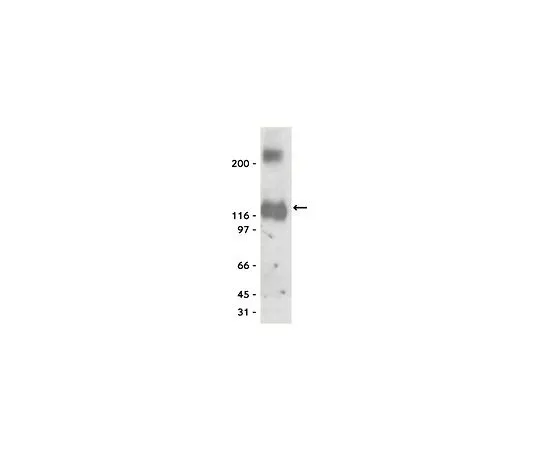 62-8385-03　抗K+/Cl-共转运体 (KCC2);100μg　07-432