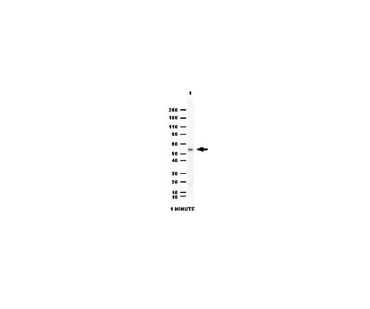 62-8459-35　抗醛脱氢酶1 (ALDH1A1);100μg　ABD12