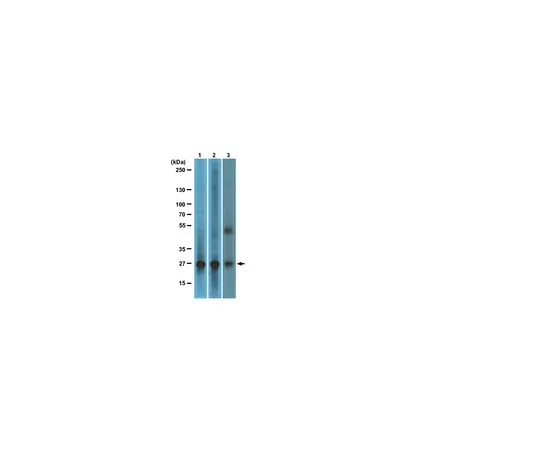 62-8367-86　抗RalB,克隆25;100μg　04-037
