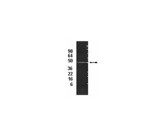 62-8368-16　抗19S调节剂非ATP酶亚基S5a/Rpn10,克隆S5a-18;100μL　04-259