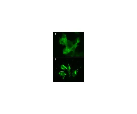 62-8394-50　慢Brite (TM) GFP-β-肌动蛋白慢病毒生物传感器　17-10204