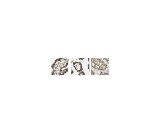 62-8466-39　抗Cullin-5 (CUL5)　ABN289