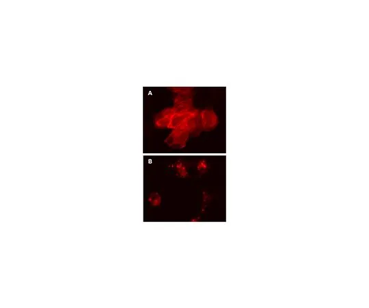 62-8394-49　慢Brite (TM) RFP-β-肌动蛋白慢病毒生物传感器　17-10203