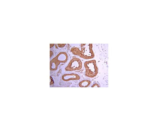 62-8387-24　抗PP6C;100μg　07-1224