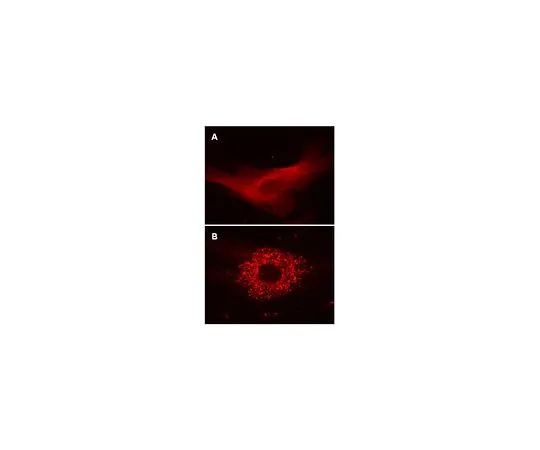 62-8394-31　慢Brite (TM) RFP-LC3慢病毒生物传感器　17-10143