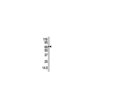62-8389-91　抗PADI4, C末端;100μg　09-796