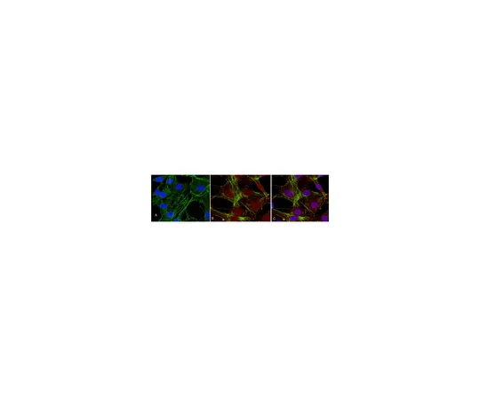 62-8373-04　抗磷酸盐 (Thr308) ，克隆50-1C-25;100μL　05-802R