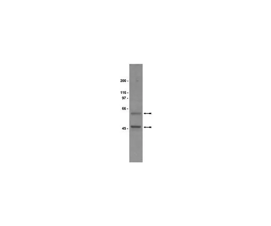 62-8381-20　抗Gsα;50μL　06-237