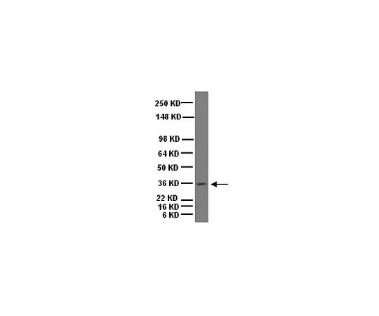 62-8452-12　反武藏1号;100μg　AB5977