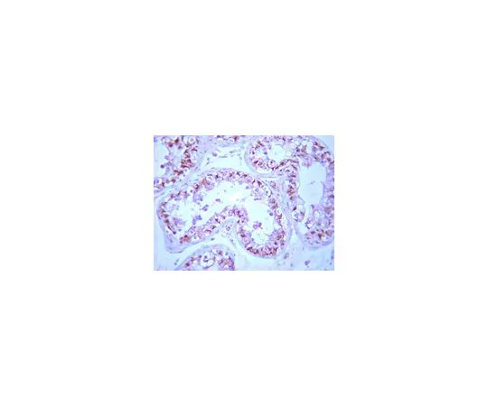62-8387-21　抗PP2A, Bβ亚基;;100μg　07-1219