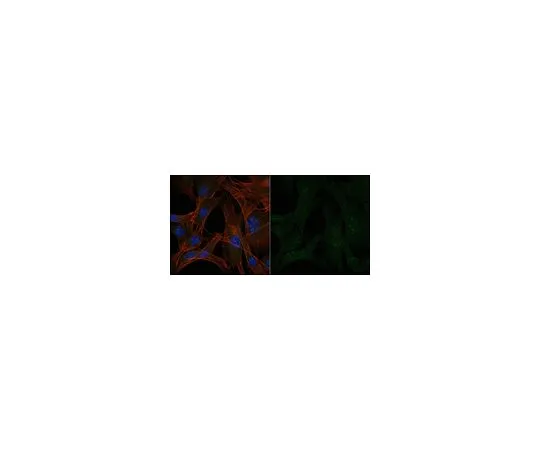 62-8444-93　抗白细胞介素-1β抗体，Alexa Fluor (R) 488共轭　AB1413-I-AF488