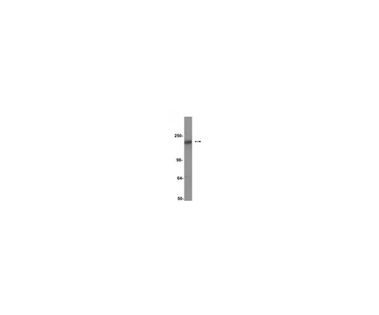 62-8371-82　抗CFTR,克隆M3A7;200μg　05-583