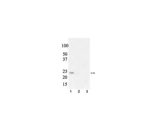 62-8386-74　抗磷eIF4E (Ser209);100μL　07-823