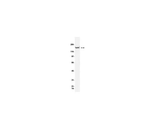 62-8371-58　抗Rad50,克隆13B3/2C6;100μg　05-525