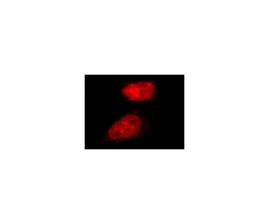 62-8394-59　慢Brite (TM) RFP-Rad51慢病毒生物传感器　17-10220