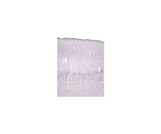 62-8445-74　抗神经源性4/5;500μg　AB1781SP