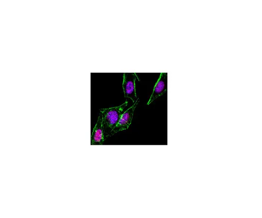 62-8374-95　抗SMAD1,克隆AS22;200μg　05-1459