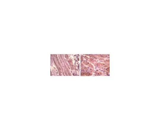 62-8446-47　抗心房钠息肉多聚异体，α;100μg　AB2232